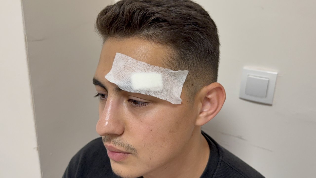 Hastanede röntgen teknisyenine saldırı! Kaşını açıp omzunu kırdı