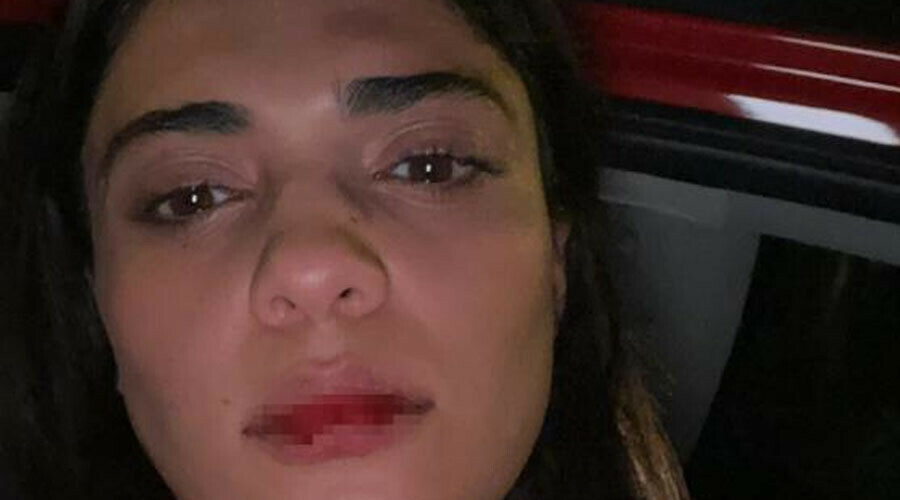 Maganda taksici trafikte terör estirdi: Azerbaycanlı şarkıcı dehşeti yaşadı