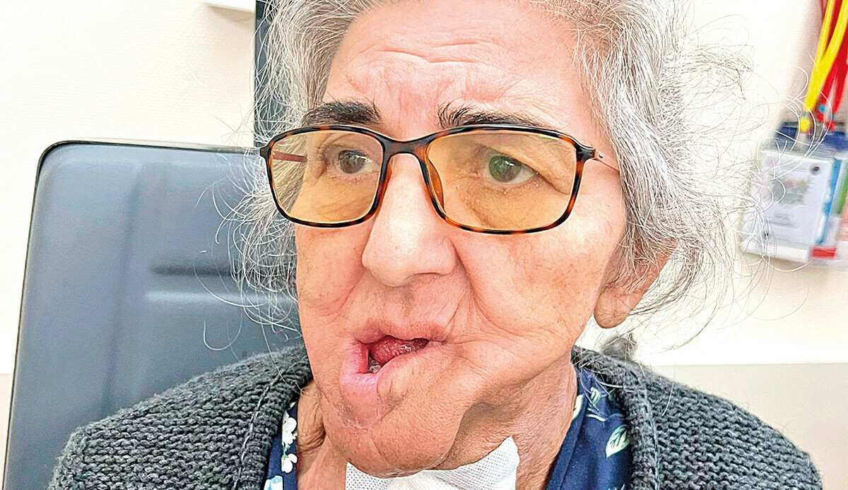 Türkiye Hastanesi&#039;nde yüz güldüren operasyon: Hâdiye Teyze&#039;ye göğüs kasından çene yapıldı