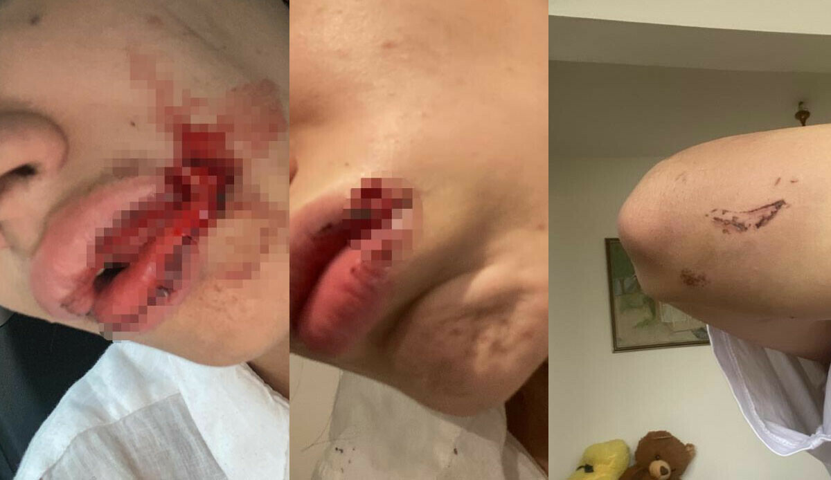 Kız kardeşlere sokak ortasında saldırı! Önce darp sonra gasp ettiler