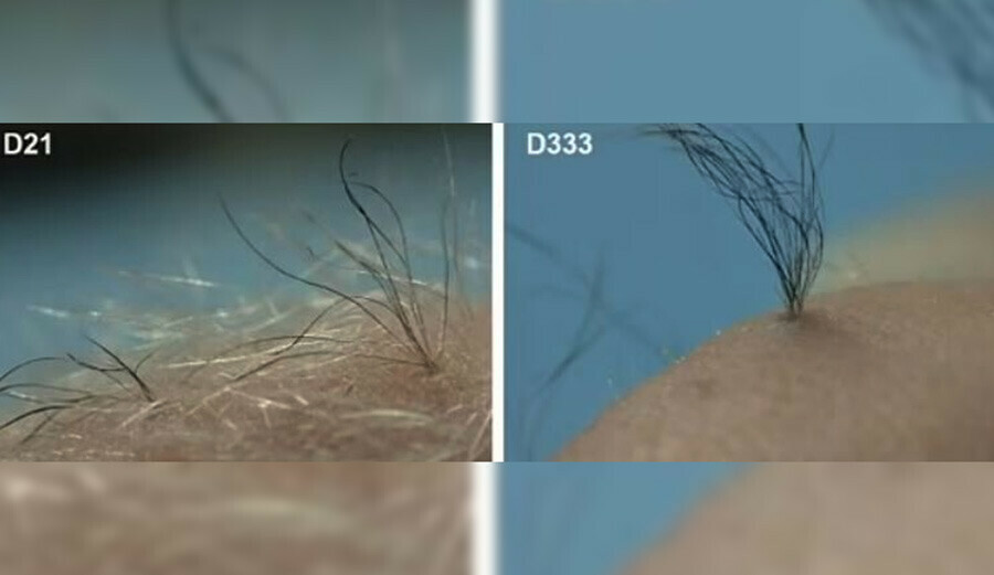 Kellik tarih oluyor: Bilim insanları laboratuvarda saç üretti