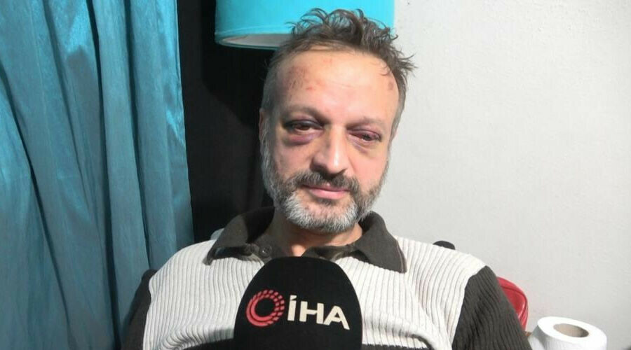 Bir istek şarkı dehşeti de Bursa’dan: Müzisyeni öldüresiye dövdüler Bir istek şarkı dehşeti de Bursa’dan: Müzisyeni öldüresiye dövdüler