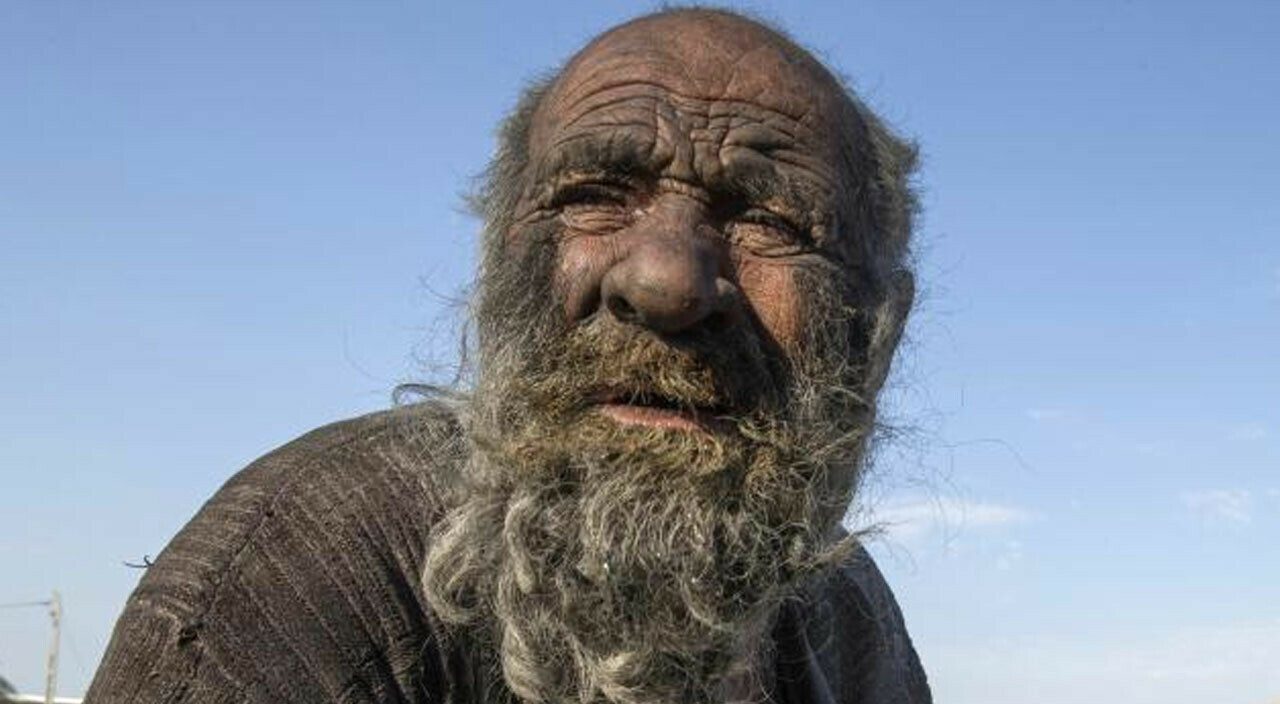 50 yıldır banyo yapmayan adamın feci sonu 50 yıldır banyo yapmayan adamın feci sonu