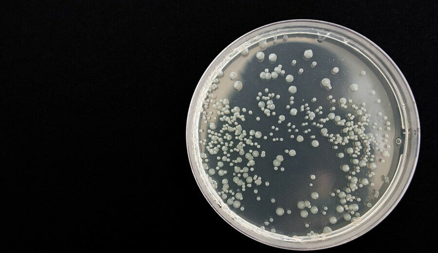 Ülkeye soktukları mantarla çiftçinin korkulu rüyası oldular! ABD medyası bunu konuşuyor Ülkeye soktukları mantarla çiftçinin korkulu rüyası oldular! ABD medyası bunu konuşuyor - 2. Resim