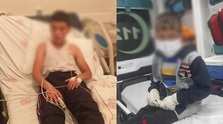 Bitlis’te sokak köpeklerinin ısırdığı çocuklardan biri kuduz çıktı