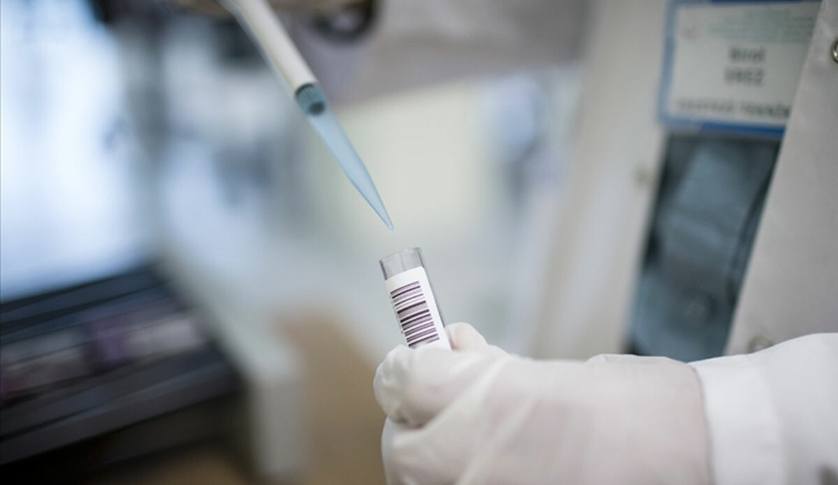 Kuduz şüphesinde hayat kurtaran yöntem! Uzmanı uyardı: Yüzde 90 oranında etkili