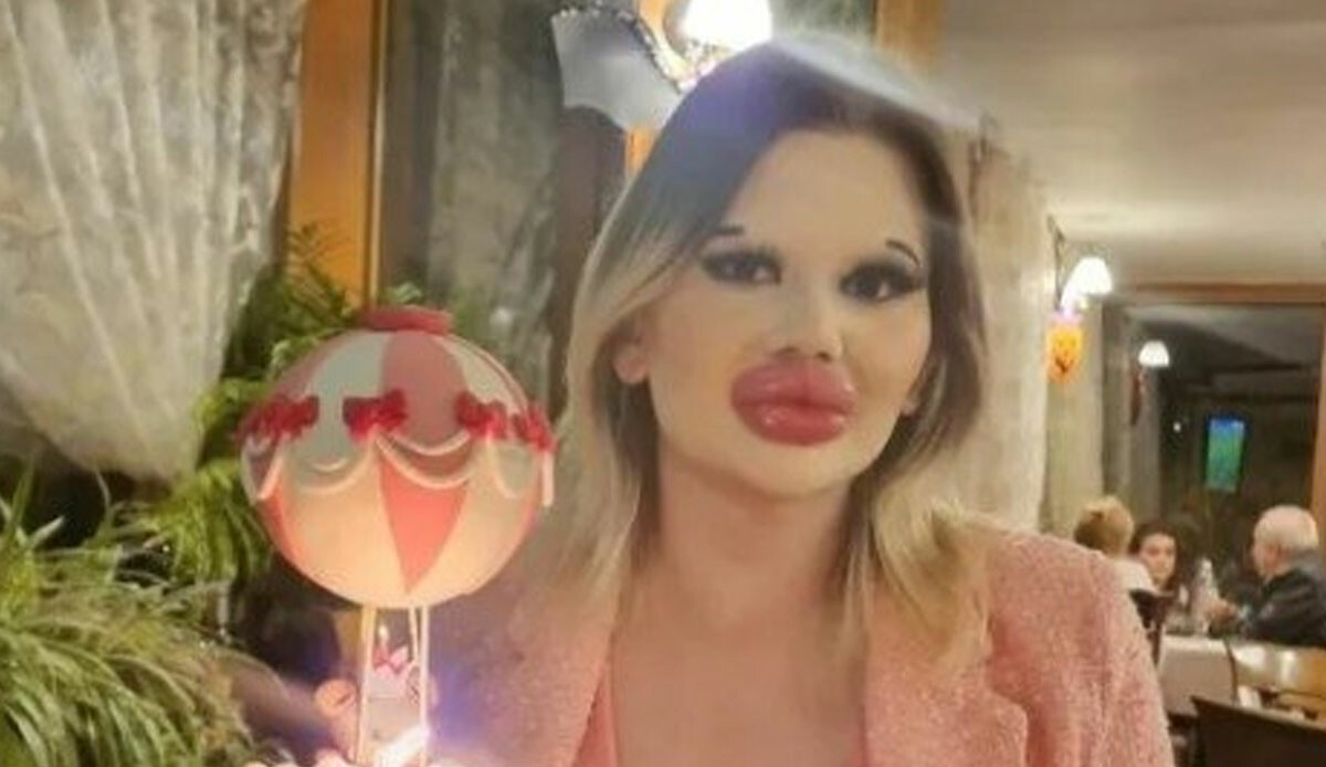 Dünyanın en büyük dudaklı kadınından yeni hamle! Ölüm riskine aldırış etmedi: Korkunç denemeyi doğum gününde yapacak