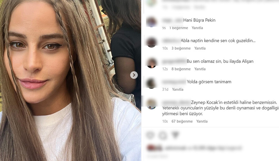 Oyuncu Büşra Pekin estetiği fazla kaçırdı, görenler tanıyamadı... 