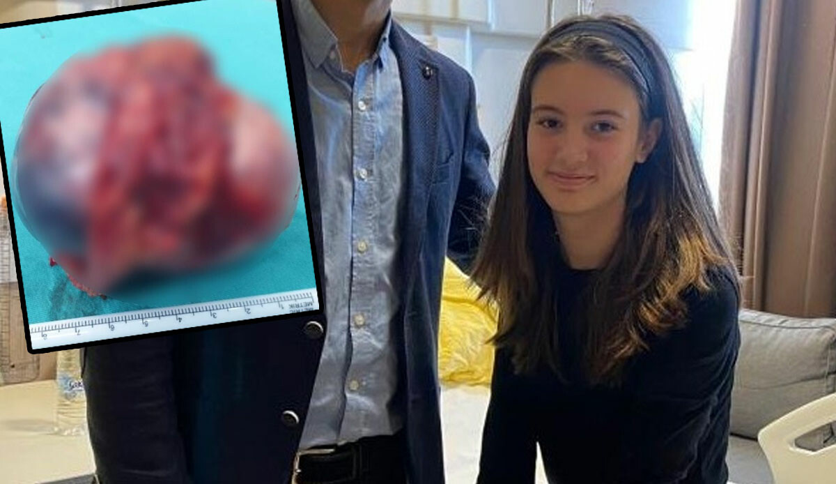 Kusma ve bulantı şikayetiyle gitti, çıkan sonuçla şaşkına döndü! Kimse inanamadı ama sonunda kurtuldu Kusma ve bulantı şikayetiyle gitti, çıkan sonuçla şaşkına döndü! Kimse inanamadı ama sonunda kurtuldu