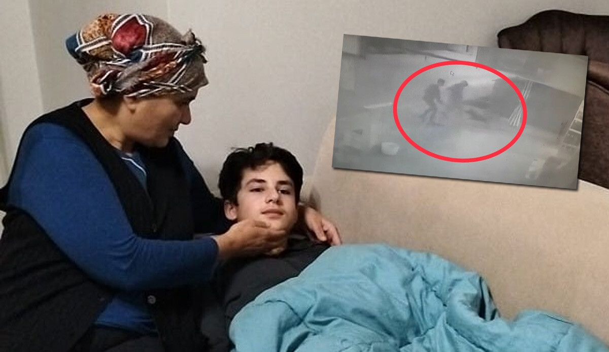 Küçük çocuğa köpek saldırdı: Ekmek almaya giderken dehşeti yaşadı