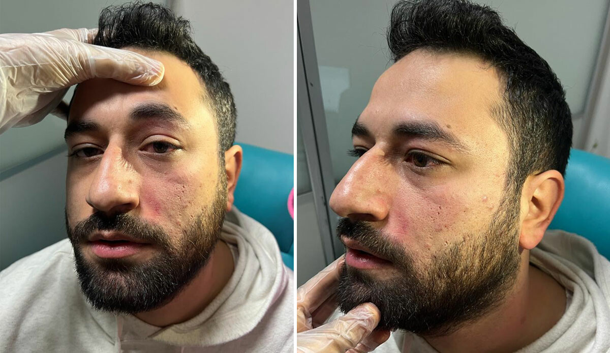 Randevuya 1 saat geç geldi, üstüne doktoru dövdü