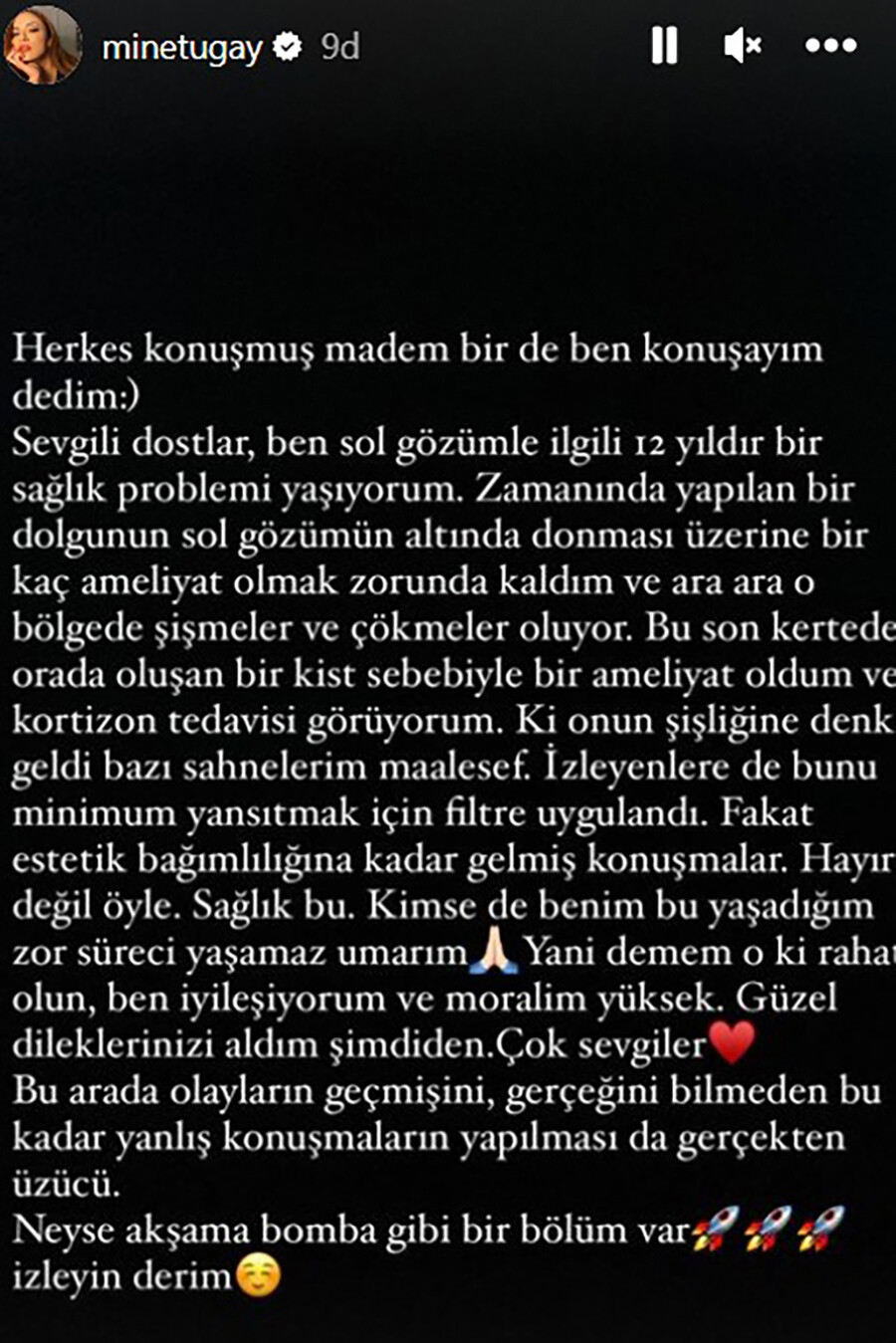 Mine Tugay estetik mi yaptırdı? Son hali olay olan oyuncu sessizliğini bozdu Mine Tugay estetik mi yaptırdı? Son hali olay olan oyuncu sessizliğini bozdu