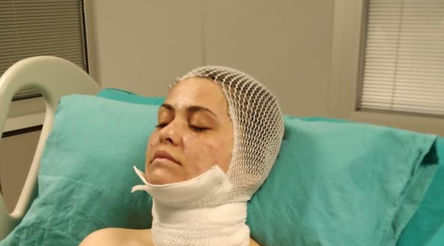 Eski eşe kimyasal saldırı: Sokak ortasında dehşeti yaşattı Eski eşe kimyasal saldırı: Sokak ortasında dehşeti yaşattı