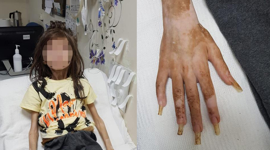 Bursa’daki çöp ev skandalında yeni gelişme: Cani teyze için 27 yıl hapis isteniyor