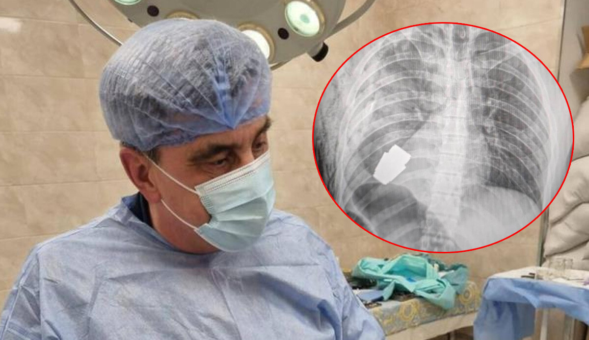 Doktorlar bile şaşkın! Vücudundan el bombası çıktı: ‘Her an patlayabilir’ Doktorlar bile şaşkın! Vücudundan el bombası çıktı: ‘Her an patlayabilir’