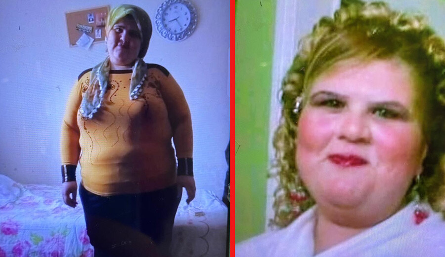 Zayıflamak isterken 250 kilo aldı… İnternetten sipariş ettiği ilaç az kalsın canından ediyordu: Ben yandım kimse yanmasın Zayıflamak isterken 250 kilo aldı… İnternetten sipariş ettiği ilaç az kalsın canından ediyordu: Ben yandım kimse yanmasın