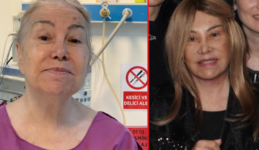 81 yaşındaki Bedia Akartürk genç görünmek için yüzünü gerdirdi, son haline yorum yağdı Ameliyat öncesi - Ameliyat sonrası