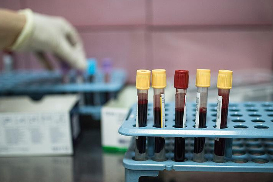 Gıdaların kara kutusunun şifrelerini çözdü! Prof. Dr. Vural Gökmen ev yapımı yemeklerde kanserojen maddelerden korunmanın yöntemlerini açıkladı Gıdaların kara kutusunun şifrelerini çözdü! Prof. Dr. Vural Gökmen ev yapımı yemeklerde kanserojen maddelerden korunmanın yöntemlerini açıkladı