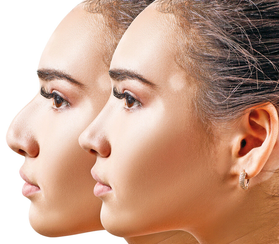 Gençlerdeki güzellik takıntısı endişe veriyor! Estetik cerrahi yaşı 15’e düştü