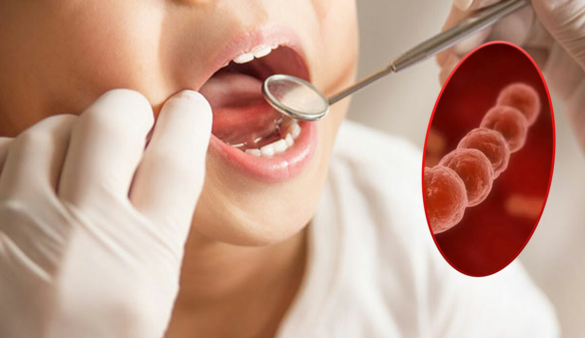 Sağlık Bakanlığı’ndan Strep A uyarısı: İlk 24 saat kritik! Bu belirtilere dikkat Sağlık Bakanlığı’ndan Strep A uyarısı: İlk 24 saat kritik! Bu belirtilere dikkat