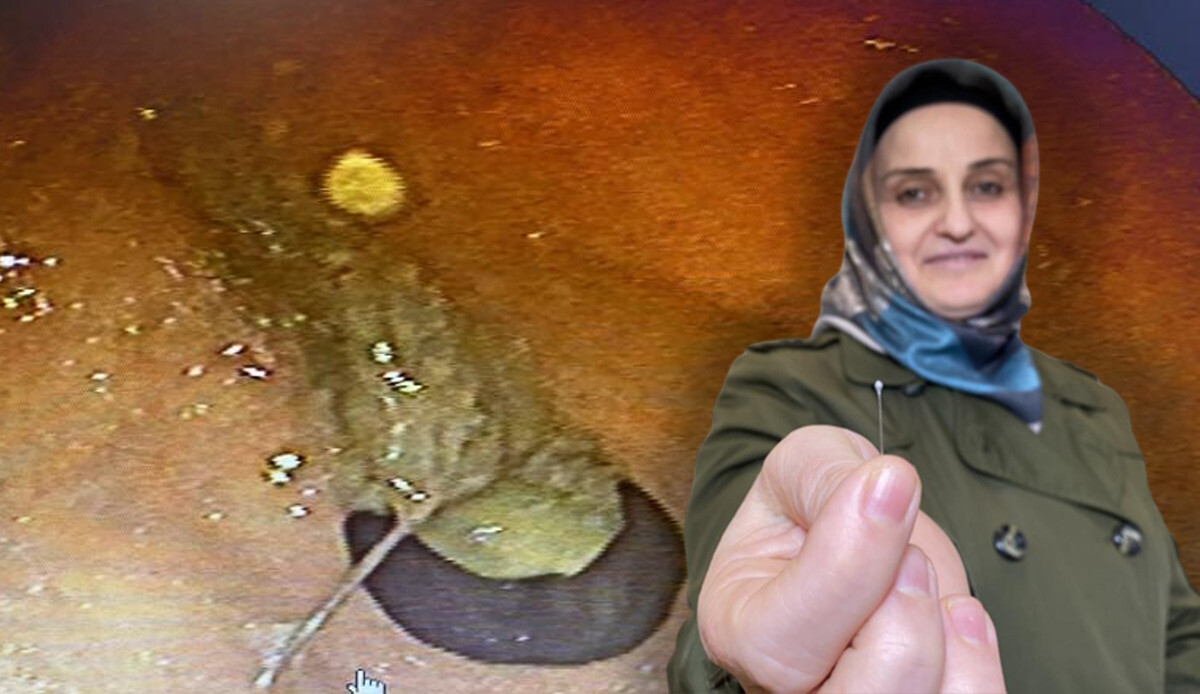 Akıllara durgunluk veren olay! Başörtü takarken hapşırdı, ağzındaki iğneyi yuttu
