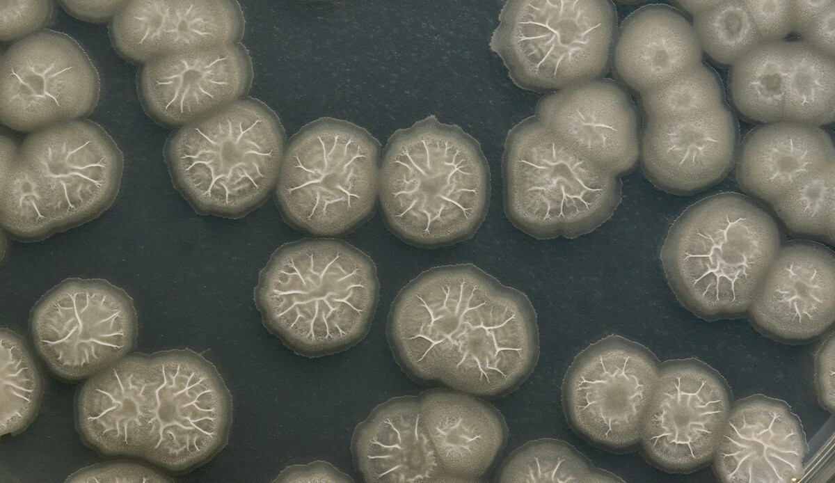 Musluk suyundan vücuduna girdi, ‘beyin yiyen amip’ nedeniyle hayatını kaybetti