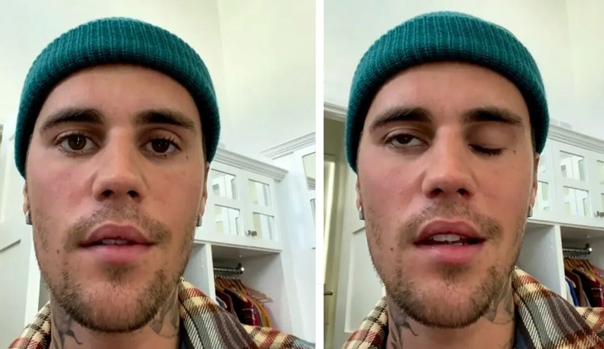 Justin Bieber sağlık sorunları nedeniyle dünya turnesini iptal etti Justin Bieber sağlık sorunları nedeniyle dünya turnesini iptal etti