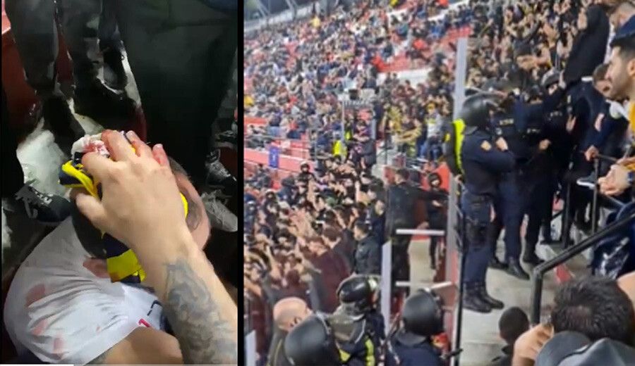 Fenerbahçe Sevilla maçında İspanya polisi tarafından darp edilen taraftarları için konunun takipçisi olacak Fenerbahçe Sevilla maçında İspanya polisi tarafından darp edilen taraftarları için konunun takipçisi olacak