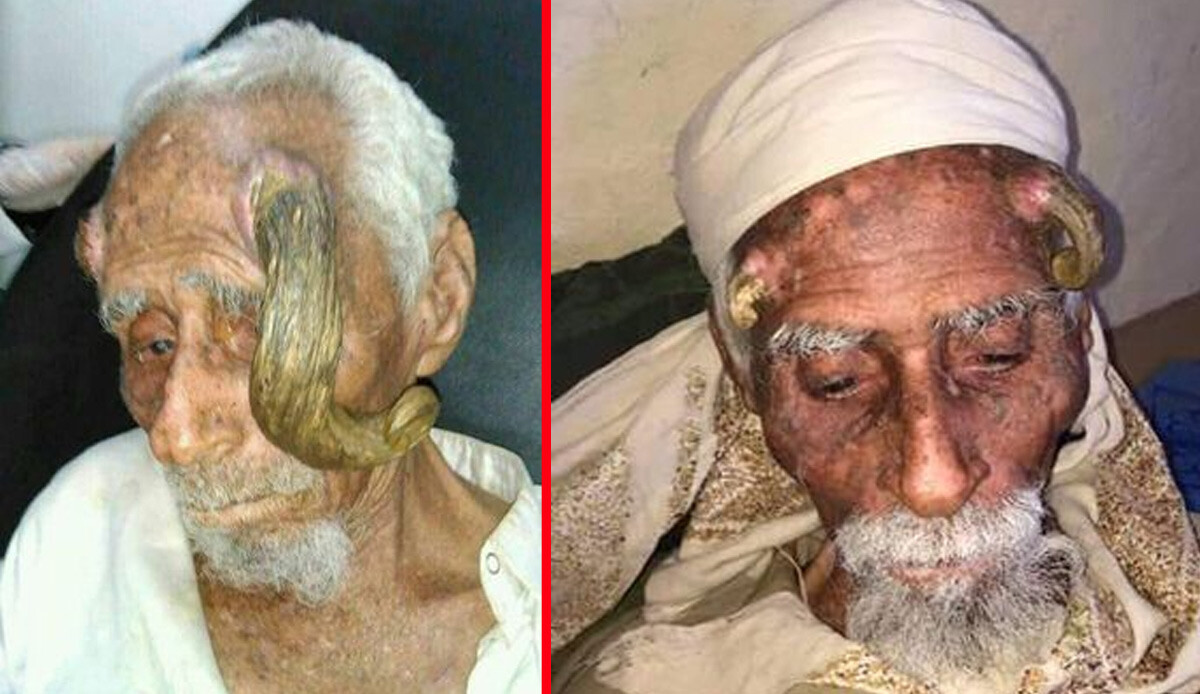 Kafasında ‘boynuz’ çıkan adam 140 yaşında hayatını kaybetti… Görenler gözlerine inanamıyor
