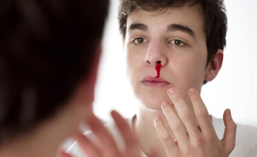 Burun kanaması orucu bozar mı? Ramazan’da burun kanamasının neden olur?