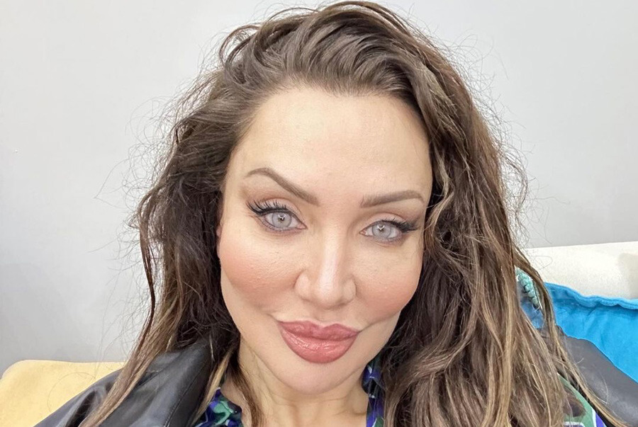 Estetiğin dozunu kaçıran Umut Akyürek bambaşka birine döndü