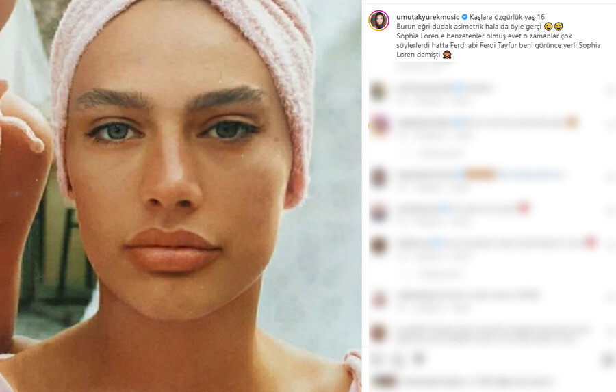 Estetiğin dozunu kaçıran Umut Akyürek bambaşka birine döndü