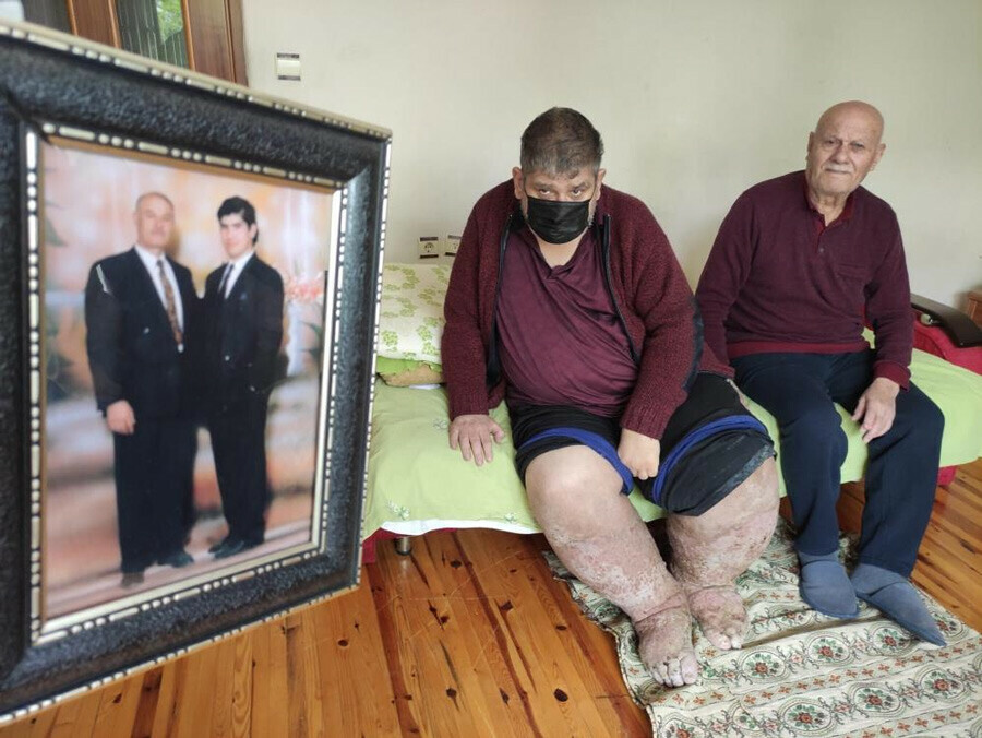 Sivrisinek ısırığı yüzünden hayatını kaybetti… Dün yardım istemişti, bugün acı haberi geldi Sivrisinek ısırığı yüzünden hayatını kaybetti… Dün yardım istemişti, bugün acı haberi geldi