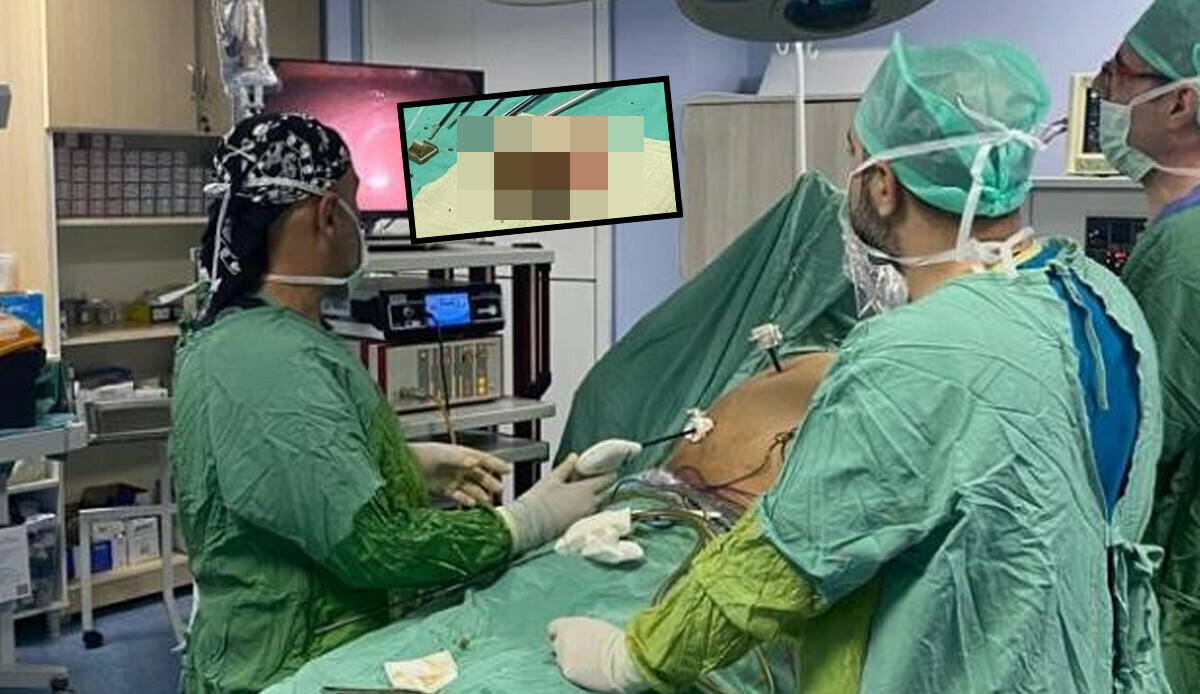 Karın ağrısıyla gittiği hastanede gerçeği öğrenince şoke oldu! Binlercesi çıkarıldı: Çok nadir görülen bir durum