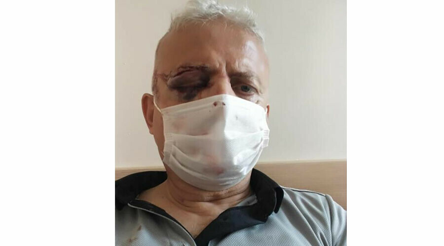 Metrobüste kör eden maske kavgasında ceza belli oldu