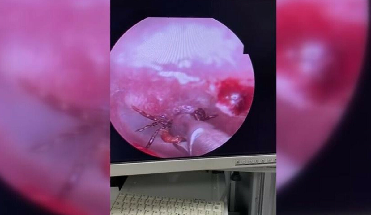 Ağrıyla gittiği hastanede kulağından çıkan şoke etti! Doktorlar uyardı: Aman dikkat