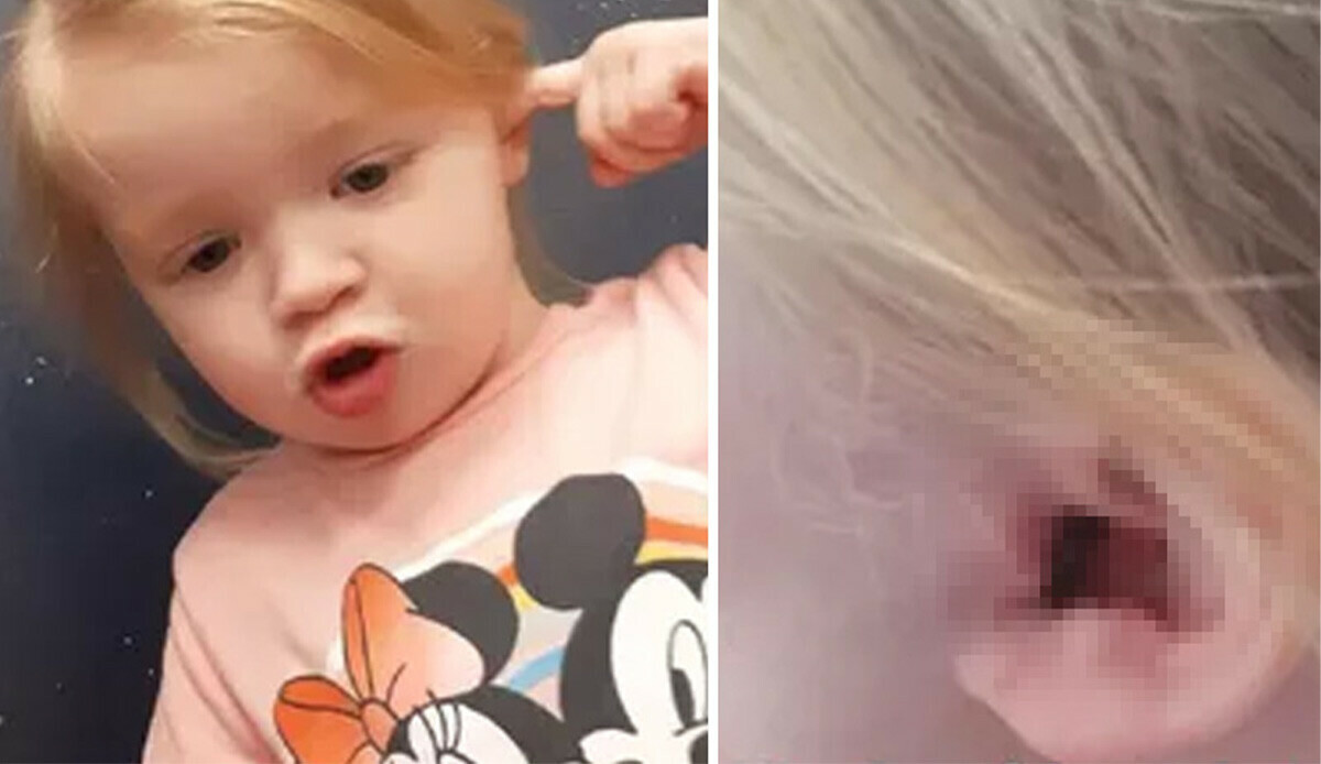 Ormanda dolanan küçük kızın kulağına üşüştüler… Annesi gerçeği hastanede öğrendi