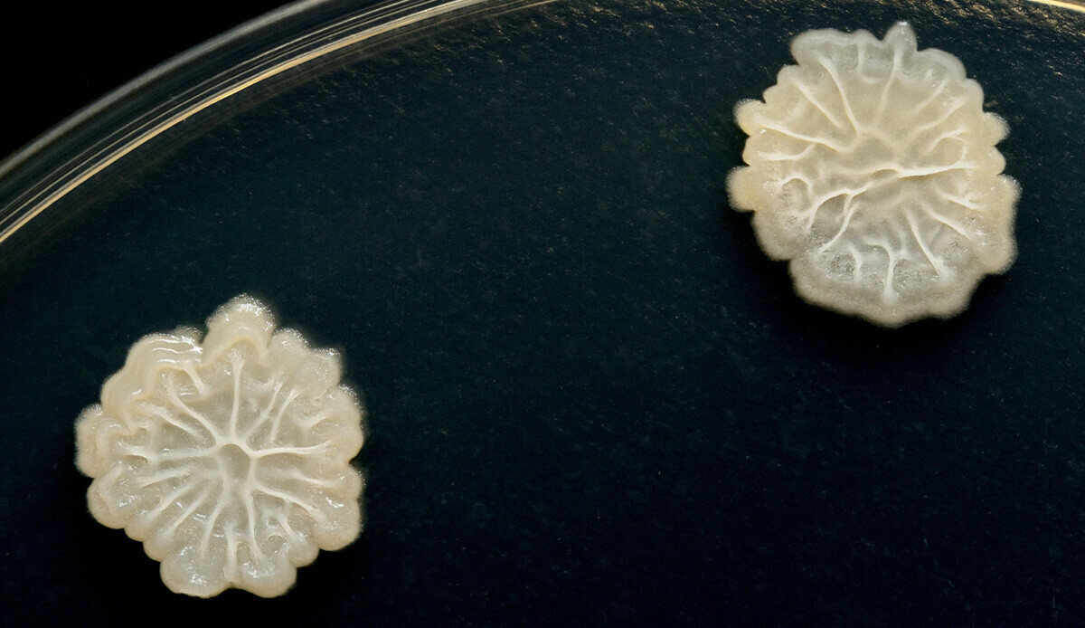 Kimsenin aklına gelmeyecek tehlike… Mikrop saçıyor, koşup hemen kaldırın