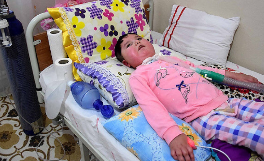 SMA hastalığı ne zaman ortaya çıkar? Belirtileri neler? SMA tanısı nasıl konur?