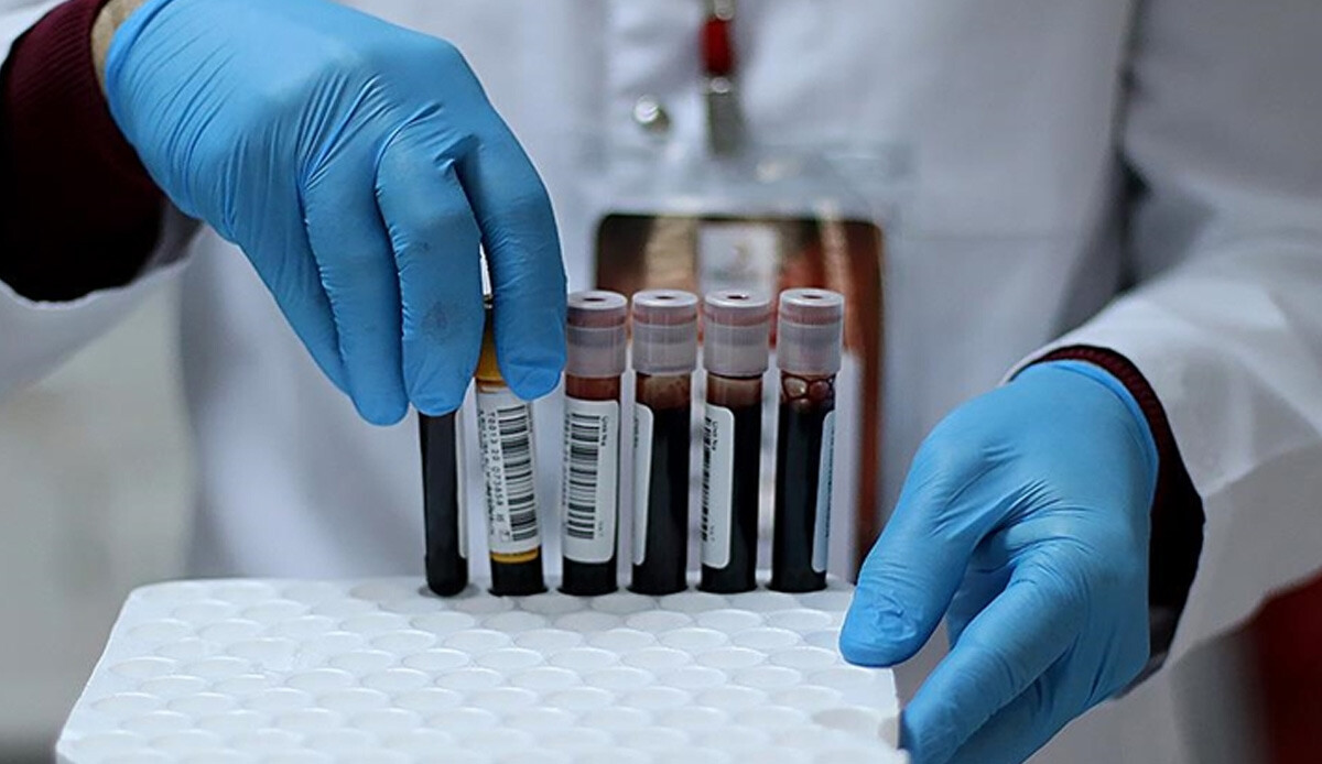 Kanser teşhisinde yeni dönem! Her üçünden ikisini tespit etti: Adeta devrim