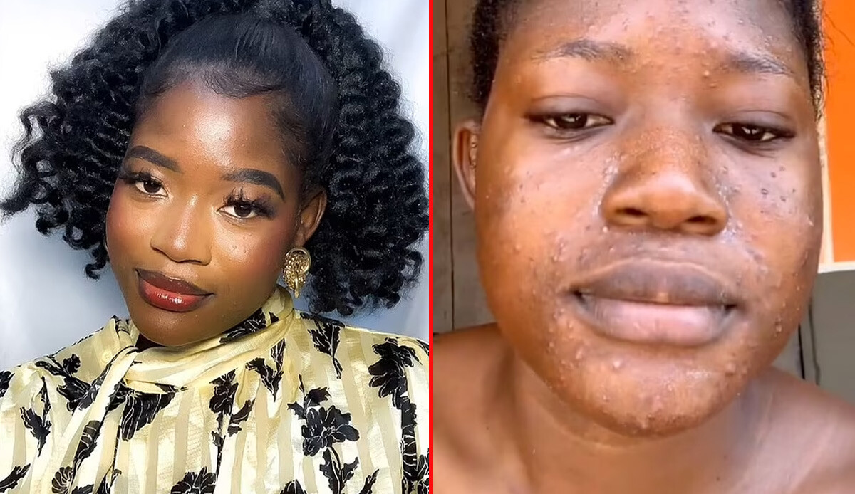 Yüzdeki tüylerinizi almadan önce tekrar düşünün: Talihsiz kadının başına gelenler çok korkunç…