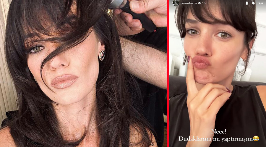 Yüzündeki farklılık dikkat çeken Pınar Deniz, estetik iddialarına cevap verdi