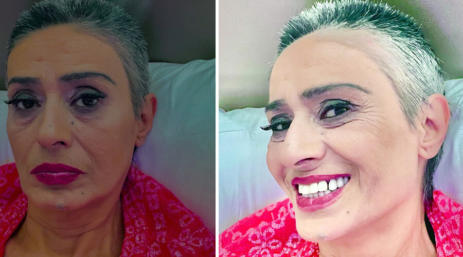 Yıldız Tilbe ‘asker tıraşı’ oldu… Fotoğrafını görenler gözlerine inanamadı Yıldız Tilbe ‘asker tıraşı’ oldu… Fotoğrafını görenler gözlerine inanamadı
