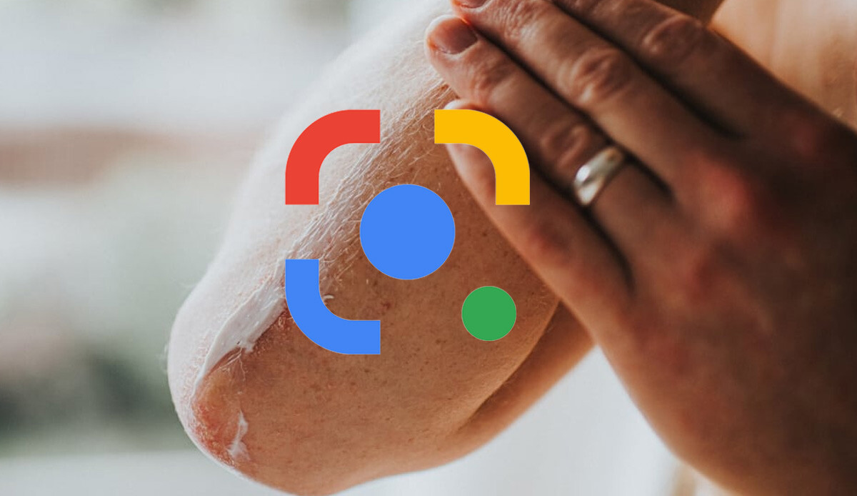 Google Lens artık cilt hastalıklarını da tespit edecek Google Lens artık cilt hastalıklarını da tespit edecek