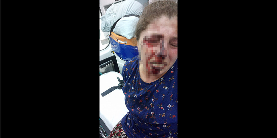 4 çocuk annesi acımasızca darp edildi! 