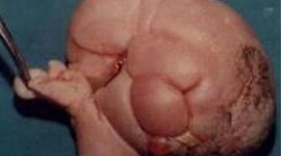 Hamile gibi görünen adam herkesi şaşırttı, gerçek 36 yıl sonra ortaya çıktı Hamile gibi görünen adam herkesi şaşırttı, gerçek 36 yıl sonra ortaya çıktı
