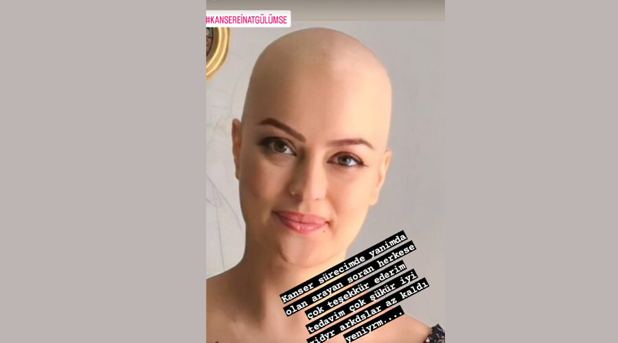 Tedavi gören genç oyuncu, peruksuz fotoğrafını paylaştı: Kansere inat gülümse Tedavi gören genç oyuncu, peruksuz fotoğrafını paylaştı: Kansere inat gülümse