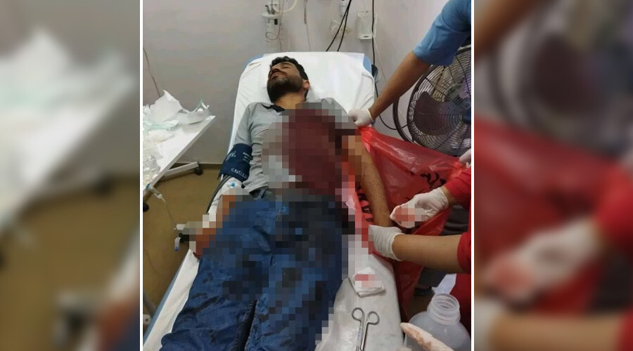 Villanın bahçesinde dehşet dolu anlar: Personel kanlar içinde kaldı