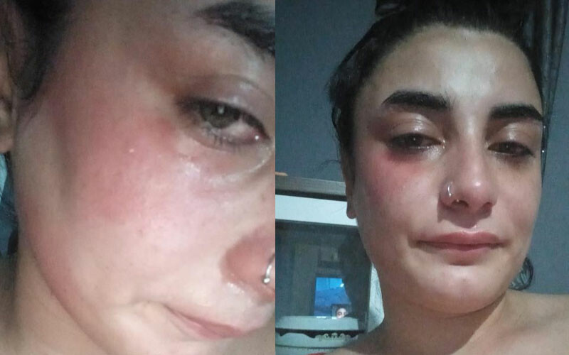 Hamile kadın markette dehşeti yaşadı! Köpek beslediği için dayak yedi, bebeğini düşürdü Hamile kadın markette dehşeti yaşadı! Köpek beslediği için dayak yedi, bebeğini düşürdü
