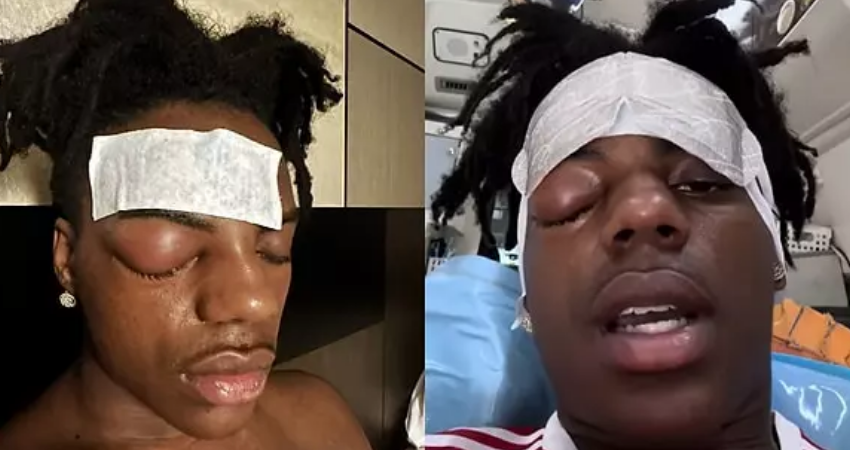 iShowSpeed hastamı, hastalığı ne? Cluster headache nedir? Küme baş ağrısı belirtileri nedir, tedavisi var mı?
